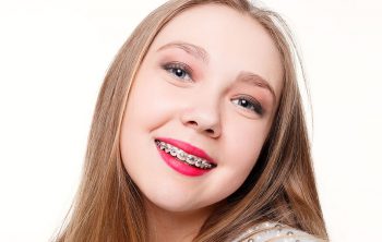 Fast Facts On Interceptive Orthodontics