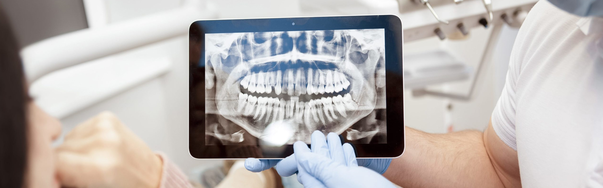 How Digital X-Rays Can Make Shorter Dental Appointments